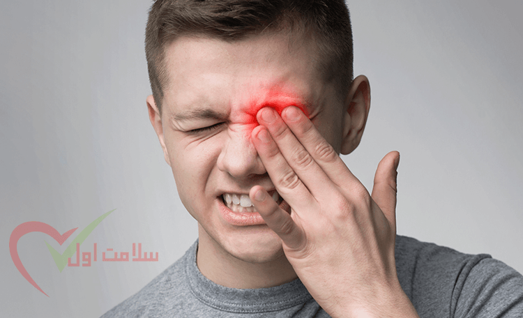 درمان‌های خانگی عفونت چشم