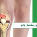 آرتروز مفصل زانو