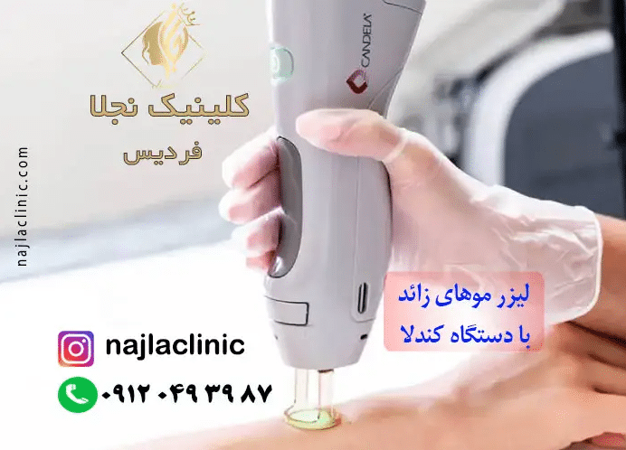 مرکز لیزر در فردیس کرج