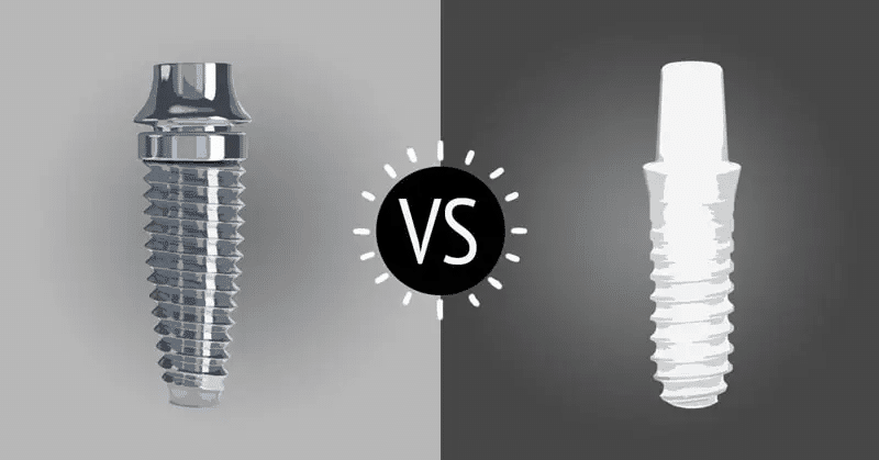 مقایسه ایمپلنت زیرکونیا با تیتانیوم