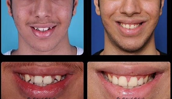 بهترین متخصص ارتودنسی در کرج